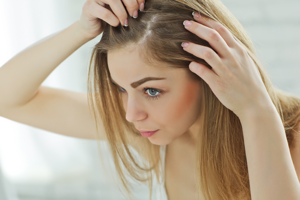 hormone imbalance symptoms thinning hair