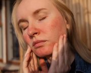 Learn how to how to minimize rosacea flare-ups naturally
