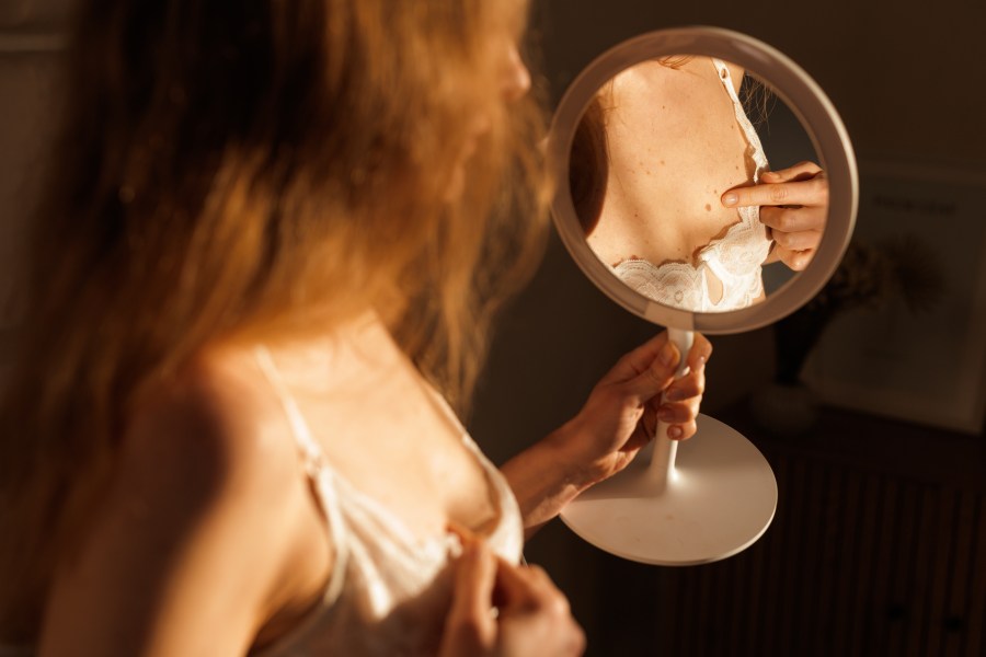 Dr Cunliffe shares the moles you should never ignore