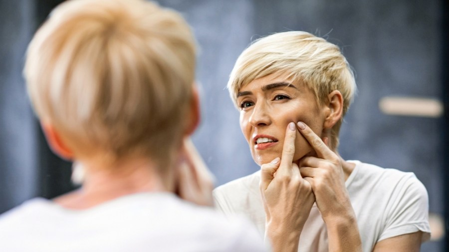 We look at some innovative new ways to treat acne in menopause