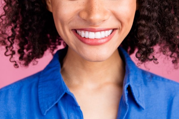 Cropped,Photo,Of,Adorable,Nice,Woman,Smiling,Showing,White,Healthy