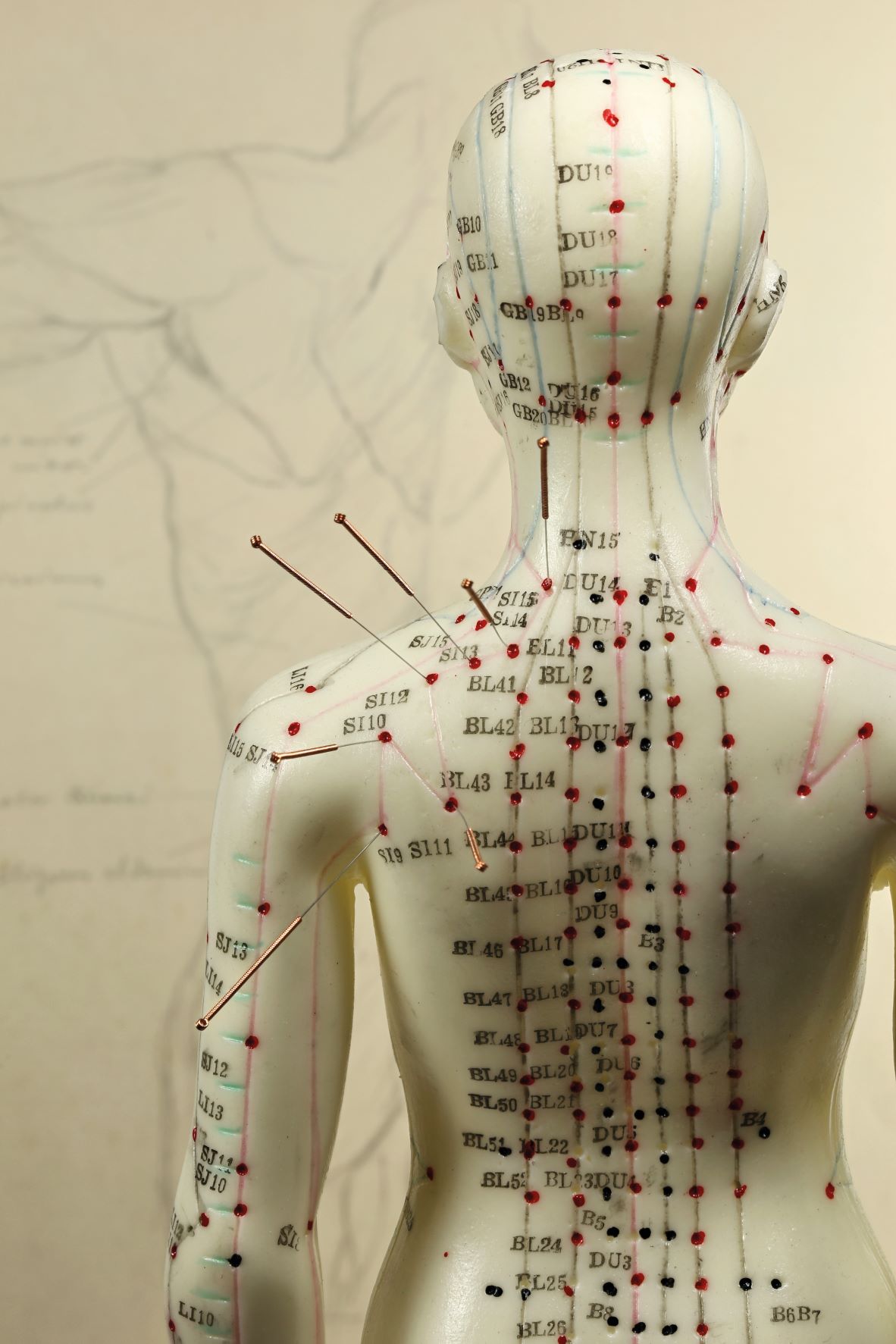 acupuncture cnm